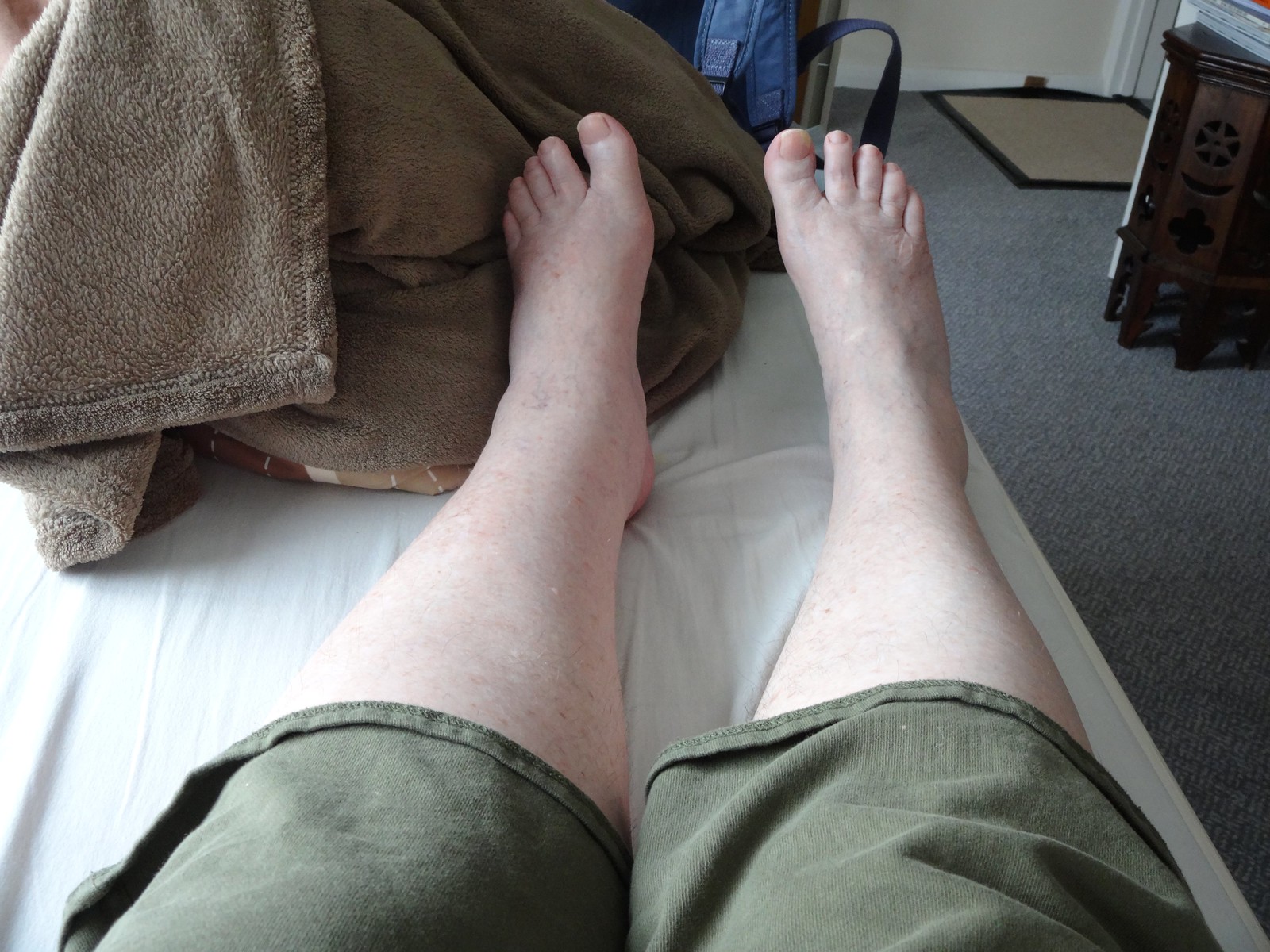 My legs, looking better