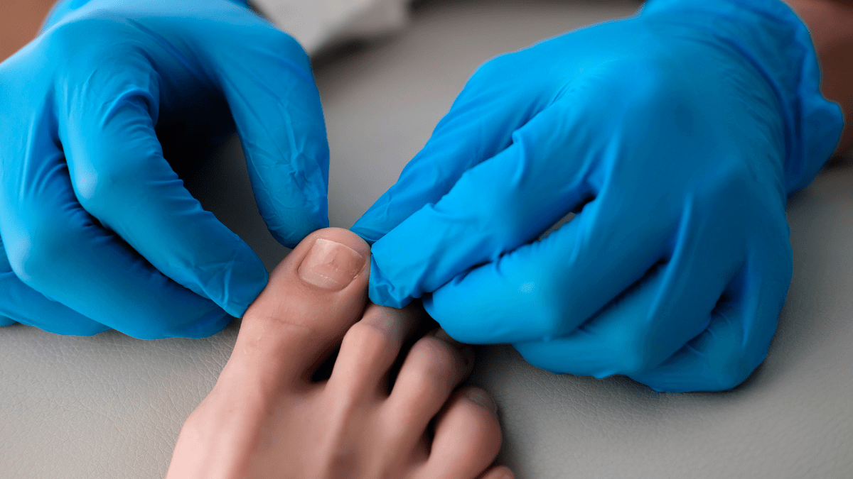 Ein Arzt mit blauen Handschuhen untersucht den großen Zeh einer Person.