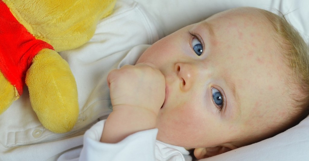 Baby mit gerötetem Gesicht liegt in einem Bettchen