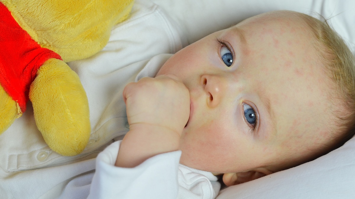 Baby mit gerötetem Gesicht liegt in einem Bettchen