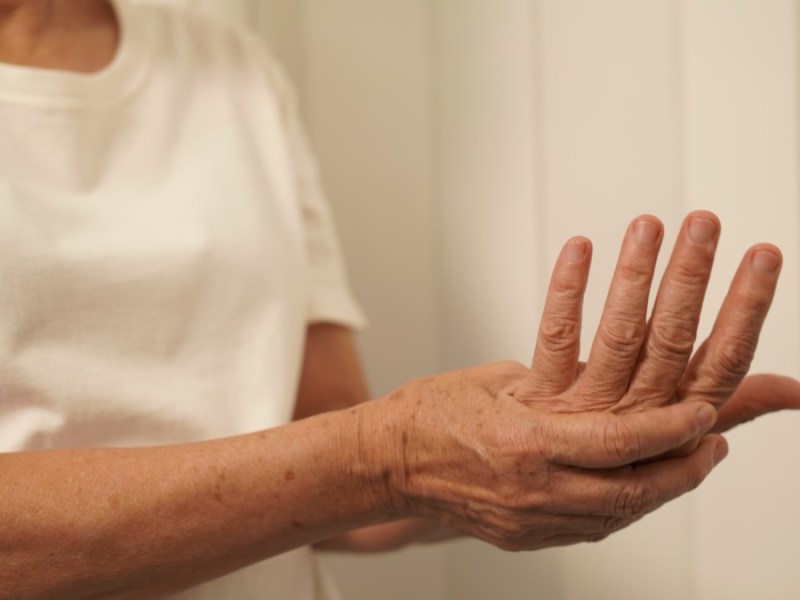 Eine Frau hält sich ihre schmerzende Hand.