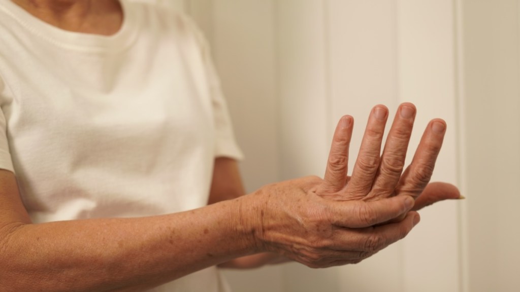 Eine Frau hält sich ihre schmerzende Hand.