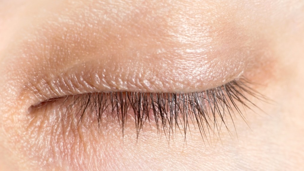 In den Wimpern können Milben leben.